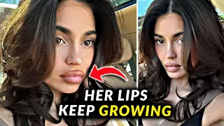 Kylie Jenner's Lips Keep On Growing Again