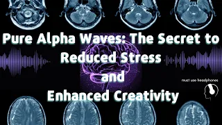 Warning: Pure Alpha Waves Can Supercharge Your Brain - Proceed with Caution