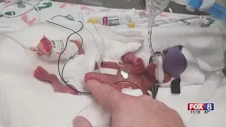 ‘He is like a miracle baby’: Micro-preemie baby makes ‘super’ recovery