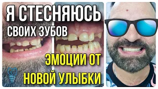 Я стесняюсь своих зубов. Эмоции от новой улыбки. Имплантация зубов.