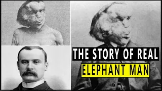 The heartbreaking story of Joseph Merrick, the real “Elephant Man”