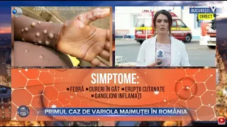 Stirile Kanal D (13.06.2022) - PRIMUL CAZ DE VARIOLA MAIMUTEI IN ROMANIA | Editie de seara