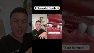 Orthodontist Reacts! Rotten Tooth Removal