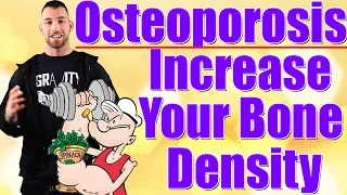 How to increase bone density | Improve Osteoporosis exercises, treatment, symptoms, causes