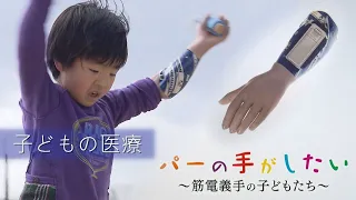 パーの手がしたい　～筋電義手の子どもたち～