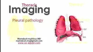 Imaging of Pleural pathology (DRE) Prof. Mamdouh Mahfouz