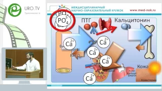 Галиев Н - Механизмы образования камней из оксалатов и фосфатов кальция