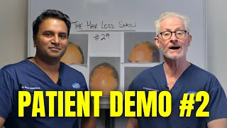 Patient Demonstration #2 | The Hair Loss Show