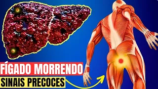 FÍGADO MORRENDO! 12 Sinais BIZARROS de FÍGADO DOENTE