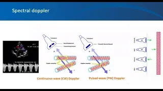 Renal ultrasound video 9, University of Florida Nephrology, Introduction to Doppler ultrasonography