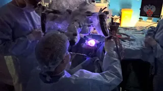 Нейрохирурги Пироговского Центра провели сложную операцию по удалению опухоли головного мозга