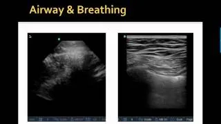 FAST Exam Case Based MS3 Video