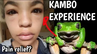 KAMBO | The Frog Medicine (My Experience)