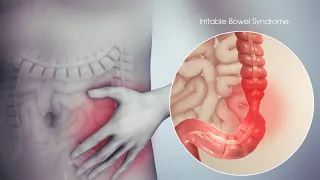 ❌ PARE de comer isso se você tem SÍNDROME DO INTESTINO IRRITÁVEL!