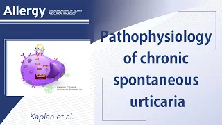 Chronic spontaneous urticaria: focus on pathophysiology to unlock treatment advances