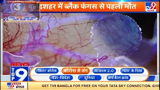 News Top 9 कोरोना से जंग : UP के Bulandshahr में Black Fungus से पहली मौत हुई