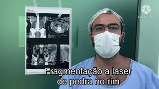 PEDRA NOS RINS / CIRURGIA A LASER PARA CÁLCULO RENAL PASSO  A PASSO