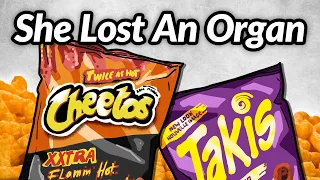 Girl Loses Organ After Eating Flamin' Hot Cheetos, This Is Why