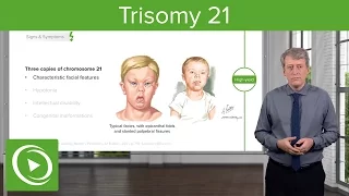 Trisomy 21 (Down Syndrome): Introduction – Pediatrics | Lecturio