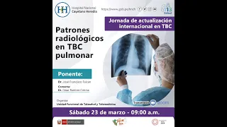 Patrones radiológicos de TBC pulmonar