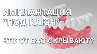 Имплантация зубов под ключ. Что это значит?