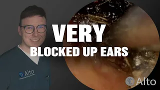 "I literally can't hear a thing..." | Earwax Removal