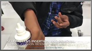 Scleral Lens Insertion and Removal