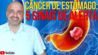 5 Sinais de Alerta para CÂNCER de ESTÔMAGO