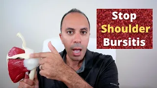 Stop Shoulder Bursitis Naturally: Symptoms, Causes, Healing Cycle & Treatment