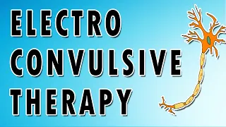 Electroconvulsive Therapy