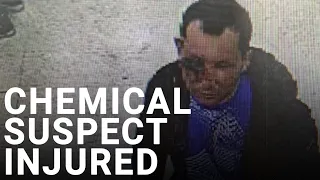 Met Police release image of suspected chemical attacker's facial injuries | Clapham Chemical Attack