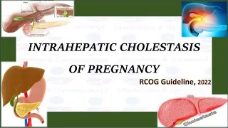 Intrahepatic Cholestasis of Pregnancy , RCOG Guideline (2022)