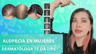 CALVICIE en MUJERES, te cuento sobre este tipo de alopecia