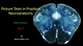 Picture Test in Neuroanatomy Brain Sections 1