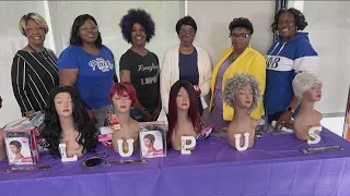 Lupus survivor helps others battling disease's effects with wig giveaway