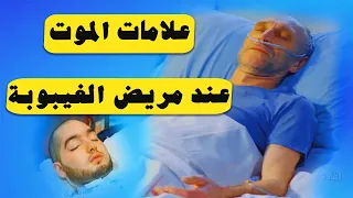 علامات الموت عند مريض الغيبوبة