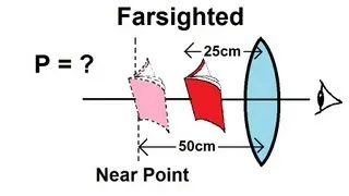 Physics - Optics: Vision Correction (4 of 5) Farsighted