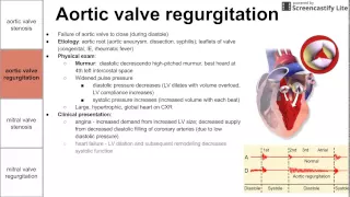 Valvular diseases of the left heart