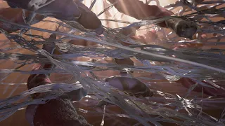 Wound Repair | MOA Animation