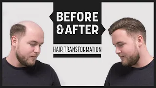 Medium Length Haircut for Men | Spring Summer Hairstyle 2017 mit Haarteil