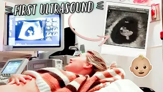 FIRST PREGNANCY ULTRASOUND + HEARING BABY'S HEARTBEAT!