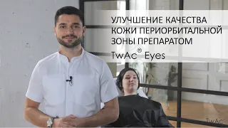 Поліпшення якості шкіри періорбітальної зони препаратом TwAc Eyes