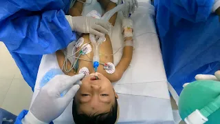 Pediatric Anesthesia Intubation Lessons - Anesthesiologist POV