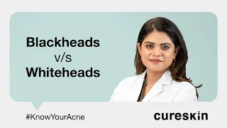 Blackheads and Whiteheads | Dermatologist explains | Cureskin