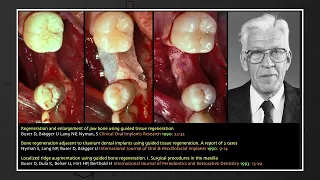 What did we learn in 30 years of implant dentistry?| Prime Time debate