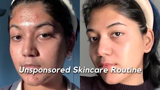 How I got rid of my ACNE, SCARS & TEXTURE | My Unsponsored Skincare Routine 🧴🫧🧖