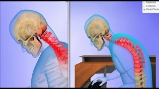 Neck Pain Explained w Exercises Stamford, Norwalk, New Canaan