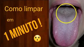 Como limpar a LÍNGUA e a SABURRA LINGUAL em 1 MINUTO !