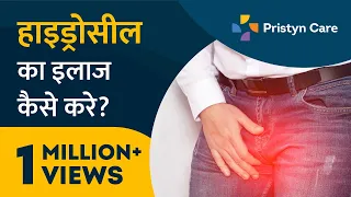 Hydrocele का इलाज कैसे करे? | अंडकोष की सूजन