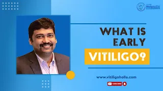 Early vitiligo - Symptoms and treatments - Dr. A P Holla | MelanoSite.